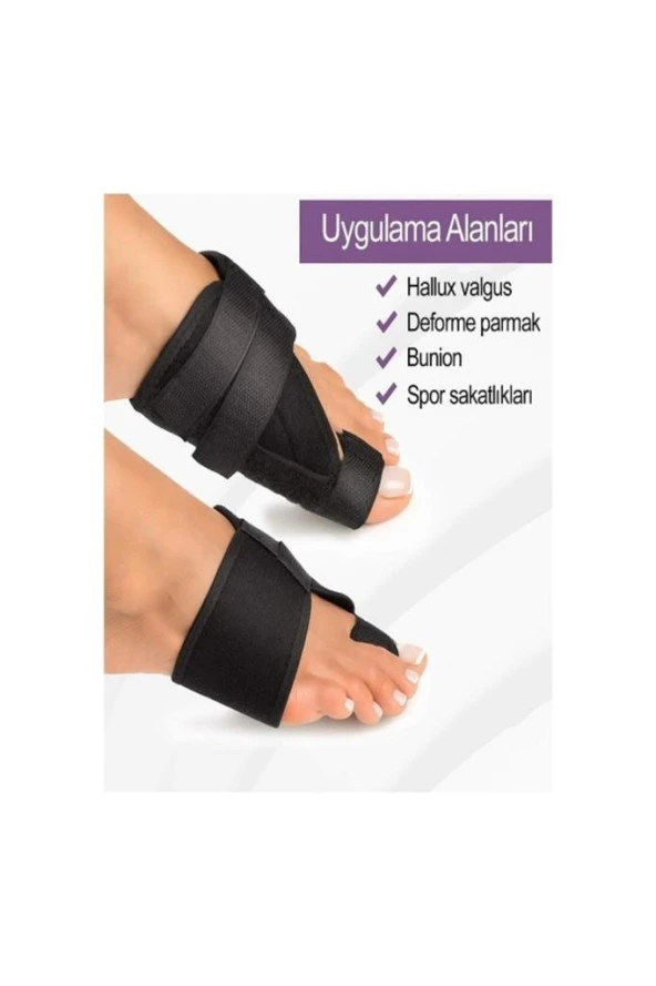 Halluks Ayak Baş Parmak Çıkıntısı Tedavisi Kemik Düzeltici Gece Ateli (çift ) - Resim 6