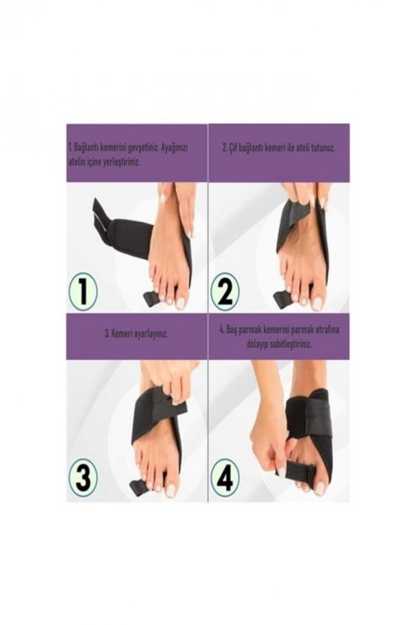 Halluks Valgus Ayak Ateli Ayak Başparmak Kemiği Çıkıntısı Bunyonu Düzeltici - Resim 2