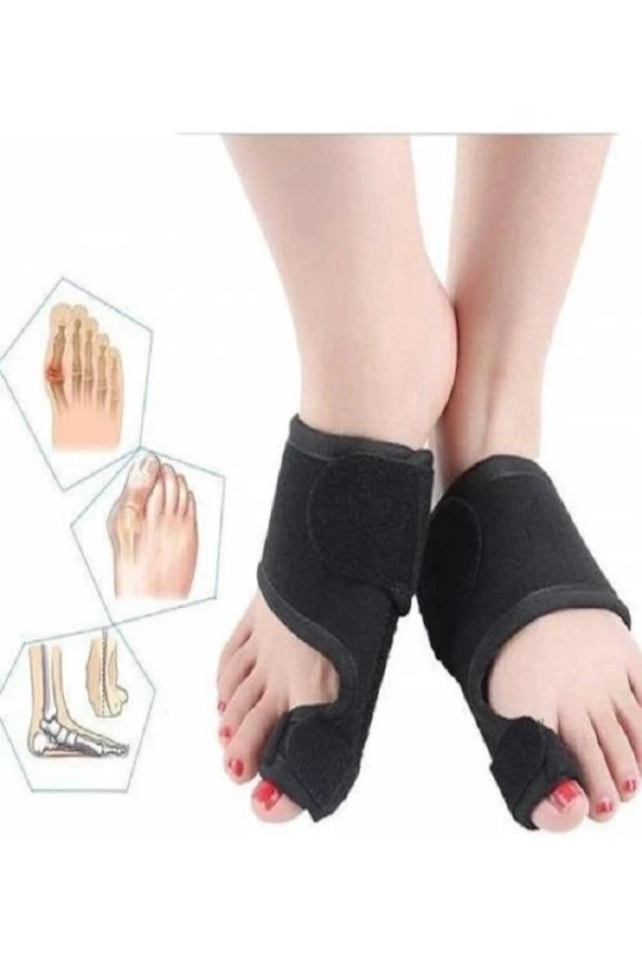 Medical Gece Ateli Ayak Bunyon Başparmak Halluks 2 Adet - Resim 2