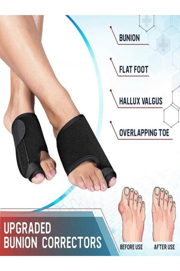 Halluks Valgus Gece Ateli Ayak Bunyon Kemik Koruyucu 1 Çift (sağ Ve Sol)