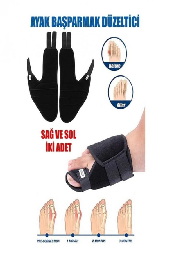 1 Çift (sağ-sol) Halluks Vagus Gece Ateli Ayak Bunyon Kemik Koruyucu Düzeltici Başparmak Tedavisi - 3
