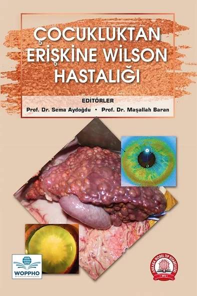 Çocukluktan Erişkine Wilson Hastalığı ürün görseli