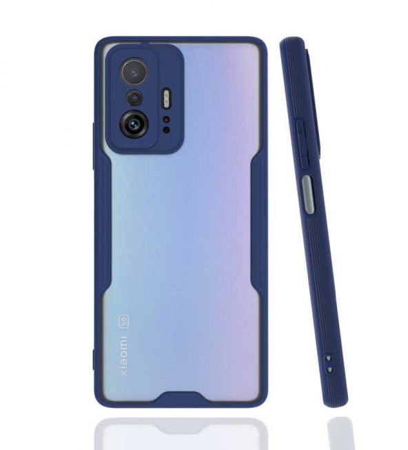 Xiaomi Mi 11T 5G Kılıf Platin Kamera Korumalı Silikon Kılıf - 5
