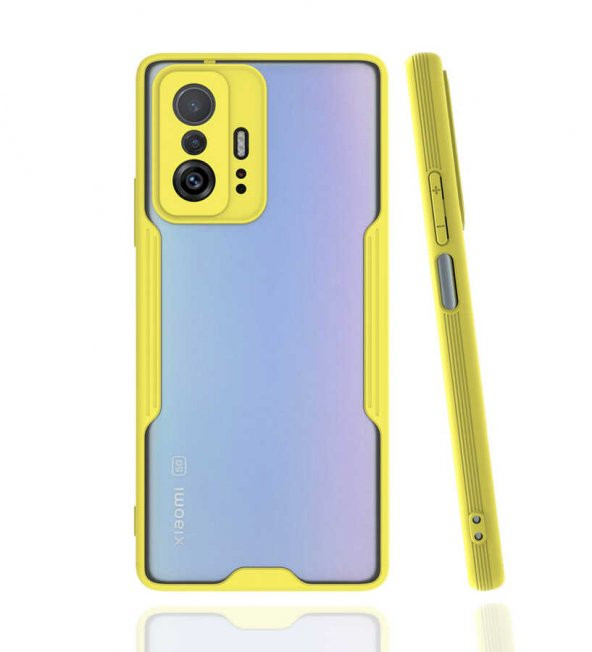 Xiaomi Mi 11T 5G Kılıf Platin Kamera Korumalı Silikon Kılıf - 7