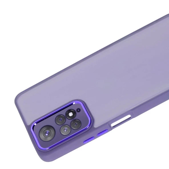 Xiaomi Redmi Note 11 Pro 4G Kılıf Freya Lazer Lens Kamera Çerçeveli Silikon Kapak - 11