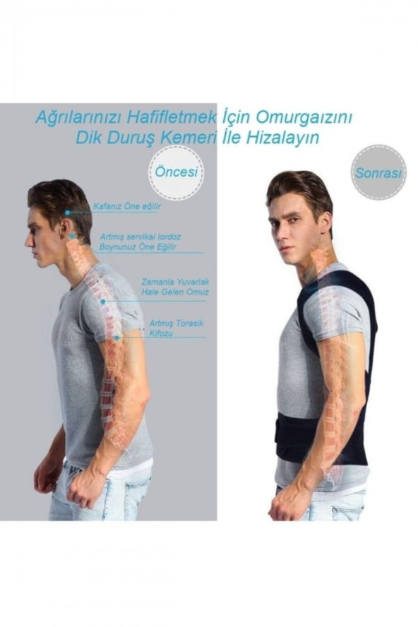 REYNEV Orjinal Dik Duruş Korsesi Sırt Desteği Omurga Düzeltici Bel Sırt Omuz Korsesi Duruş Düzeltici Korse - 5