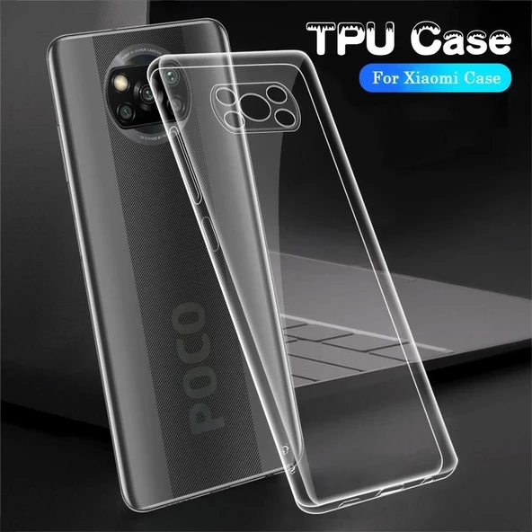 Smcase Xiaomi Poco X3 NFC Kılıf Lüks Kamera Korumalı Silikon Nano Ekran Koruyucu - 3
