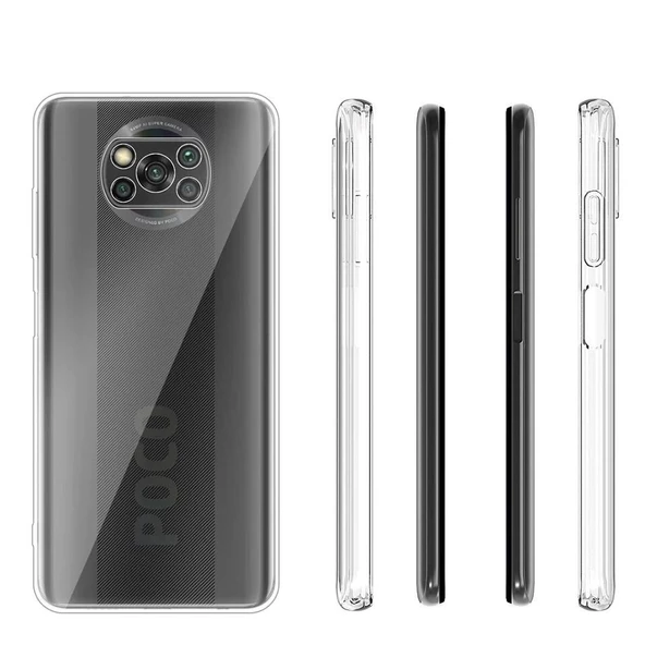 Smcase Xiaomi Poco X3 NFC Kılıf Lüks Kamera Korumalı Silikon Nano Ekran Koruyucu - 2