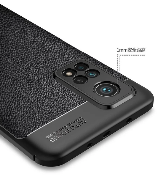 Smcase Xiaomi Mi10T Kılıf Deri Dokulu Silikon - Resim 2