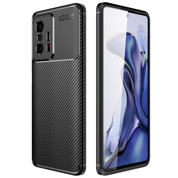 Smcase Xiaomi 11T Pro Kılıf Kamera Korumalı Karbon Dokulu Silikon