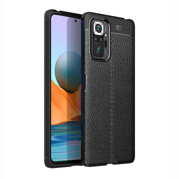 Smcase Xiaomi Redmi Note 10 Pro Max Kılıf Deri Dokulu Silikon  Nano Ekran Koruyucu