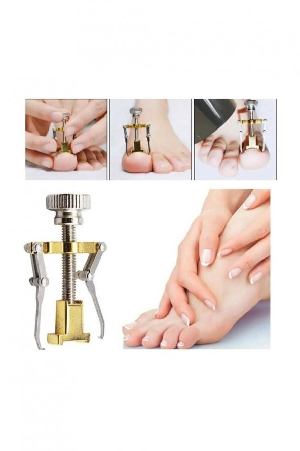 BATIK TIRNAK ÇIKARICI - 2