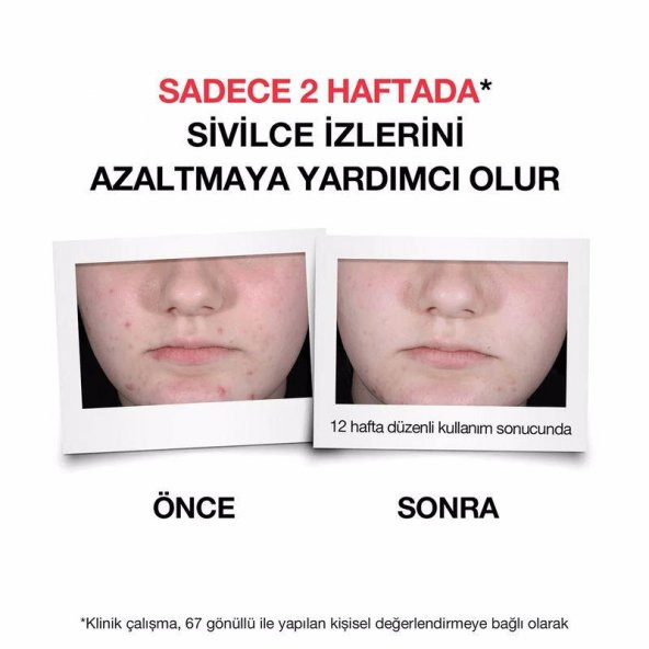 Neutrogena Sivilce Karşıtı Günlük Serum 30 ml - 6