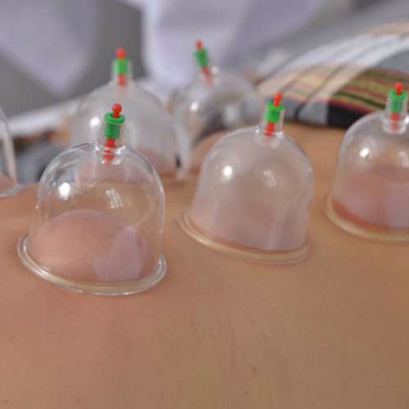 qosrix VAKUMLU HACAMAT KUPASI BARDAK KUPA ÇEKME SETİ MASAJ ALETİ 12 LI SET 12 ADET KUPA 1 ADET VAKUM POMPASI - 3