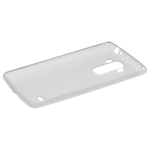 LG G4 Stylus Kılıf Soft Silikon Şeffaf-Siyah Arka Kapak - 2