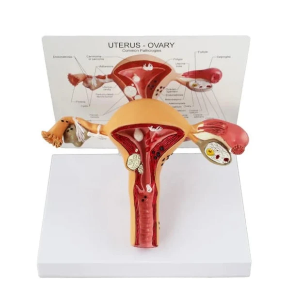 Uterus Pelvik Taban Maketi Model 41 - 2