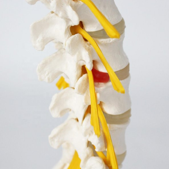 Omurga Bel Maketi Model 23 - 3