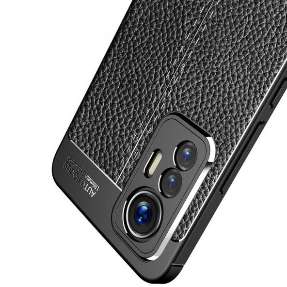 Xiaomi Mi 12 Lite Kılıf Focus Deri Görünümlü Kamera Korumalı Silikon Kılıf - Resim 3