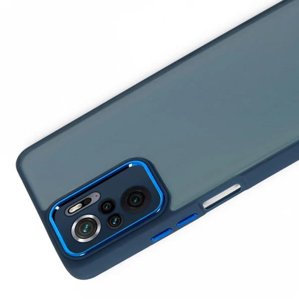 Xiaomi Redmi Note 10 / 10s Kılıf Freya Lazer Lens Kamera Çerçeveli Silikon Kapak - 5