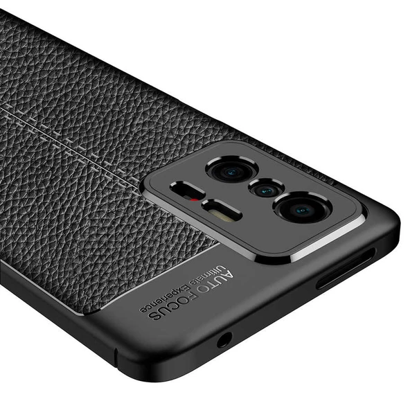Xiaomi Mi 11T 5G Kılıf Zore Niss Deri Desenli Silikon Kılıf - Resim 10