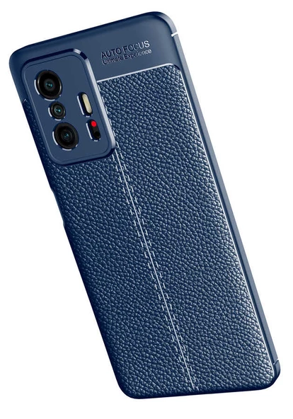 Xiaomi Mi 11T 5G Kılıf Zore Niss Deri Desenli Silikon Kılıf - Resim 5