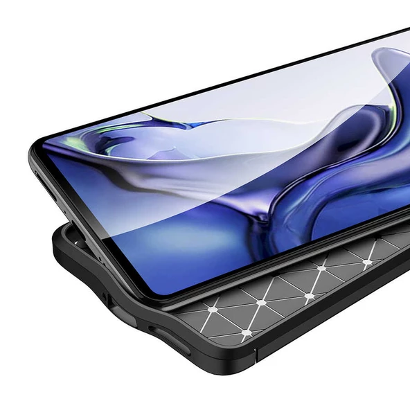 Xiaomi Mi 11T 5G Kılıf Zore Niss Deri Desenli Silikon Kılıf - Resim 7