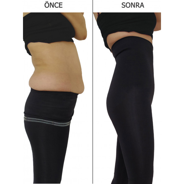 Korse Tayt Siyah Kadın Tayt Göbek Basen Toparlayıcı Tayt Doğum Sonrası Korsesi Spor Taytı - 3