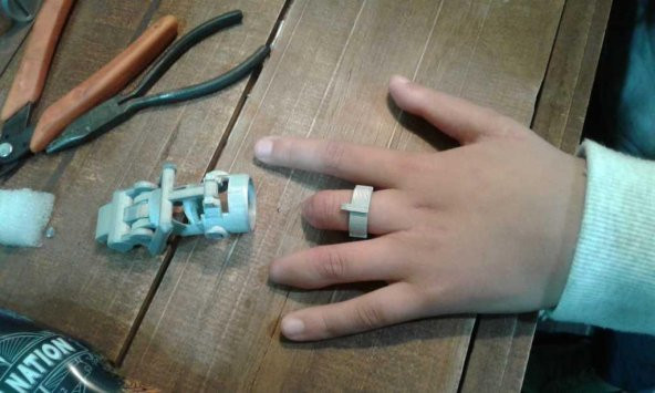 Mekanik Parmak Halka Protez Plastik Aparat - 1