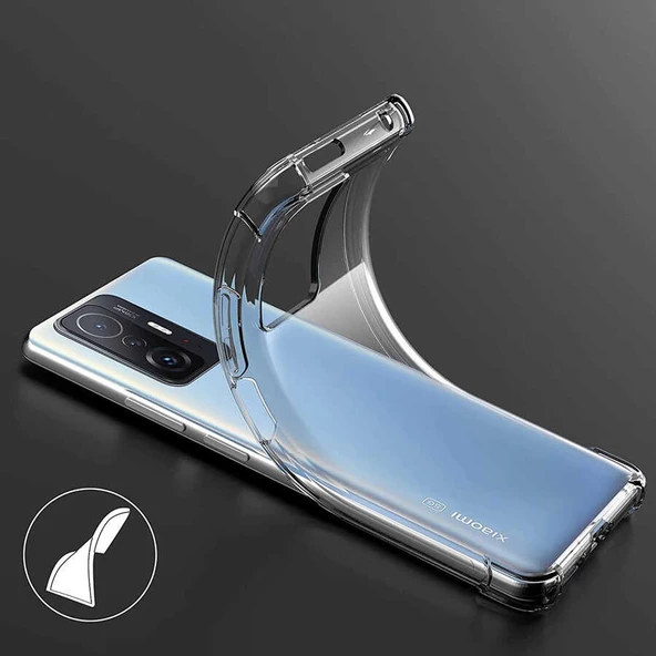 Gpack Xiaomi Mi 11T 5G Kılıf AntiShock Ultra Koruma Sert Silikon - Resim 2