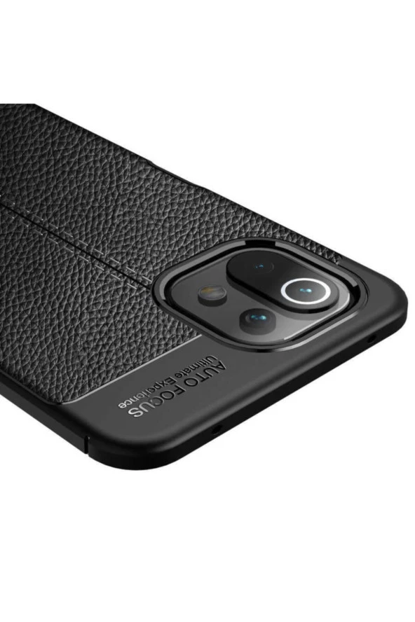 Xiaomi Mi 11 Lite Uyumlu Kılıf Niss Silikon Deri Görünümlü Lacivert - Resim 4