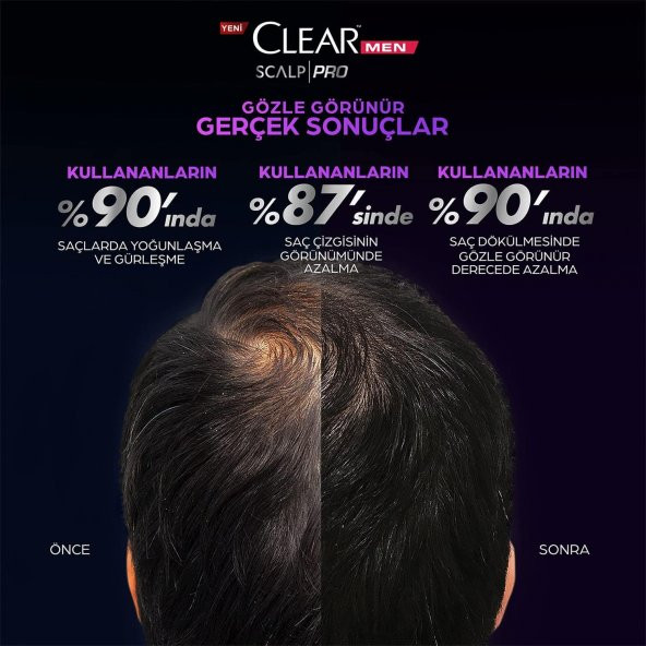 Clear Men Scalp Pro Saç Dökülmesine Karşı Güçlendirici Şampuan 300ML - 6