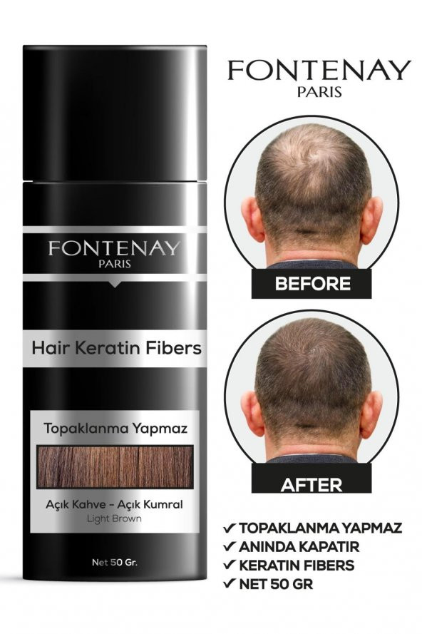 Fontenay Saç Dolgunlaştırıcı Keratin Fibers Açık Kahve Topik Saç Tozu 50gr X2 - 2