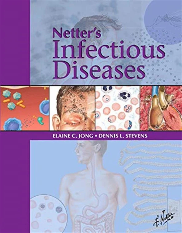 Netter's Infectious Disease Elaine C. Jong MD FIDSA FASTMH