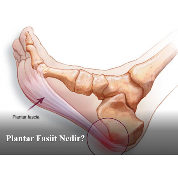 Plantar Fasiit Topu-Duyu Topu Dikenli Masaj Egzersiz Topu El Ayak Sırt Topuk Masajı Kas Çalıştırma - 2