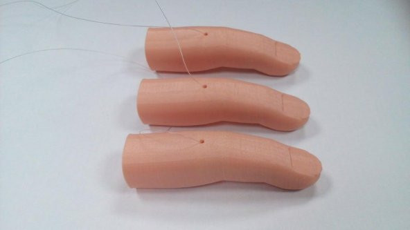 Flexy-Parmak Protezi Plastik Aparat - 3