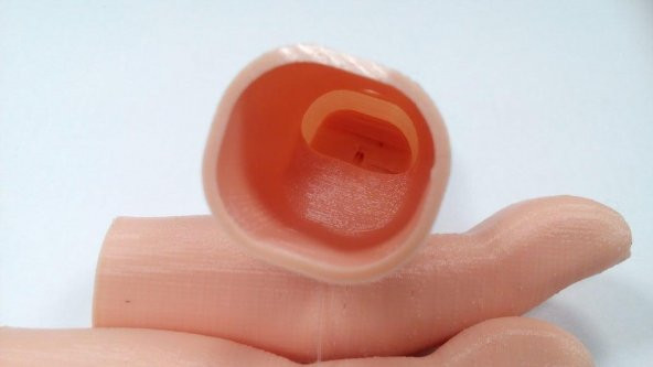 Flexy-Parmak Protezi Plastik Aparat - 5