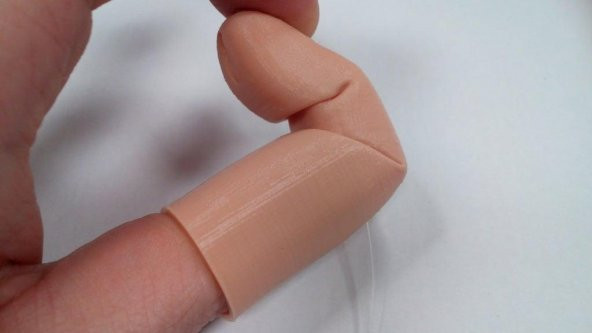 Flexy-Parmak Protezi Plastik Aparat - 6