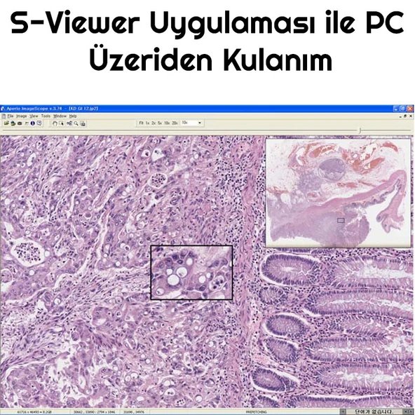 TriLine 2000X Zoom Biyolojik HD Dijital Monoküler Mikroskop Kiti - 7