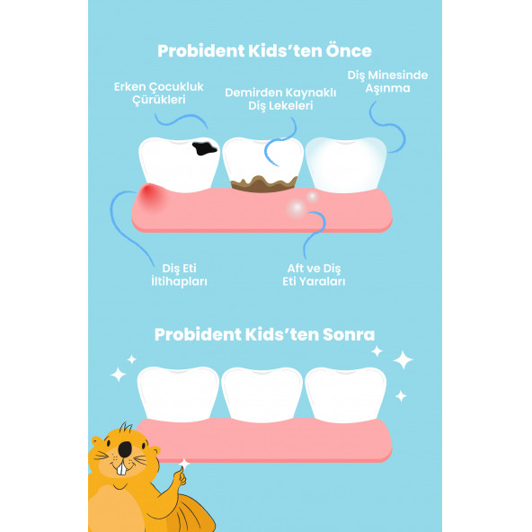 Probident Aktif Probiyotikli Üzüm Çekirdeği Özüt İlaveli Doğal Elma Aromalı Kids Tanışma Paketi - 4