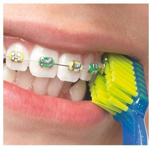 Curaprox Ortho Ortodonti 5460 Diş Fırçası - 2