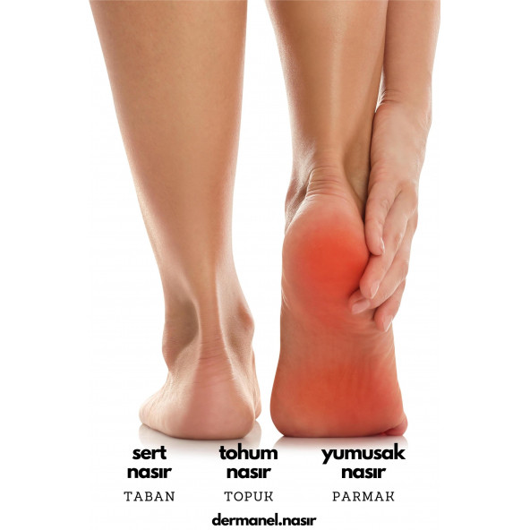 Dermanel Ayak Bakım Spreyi+Dermanel Nasır Tedavi Seti - 7