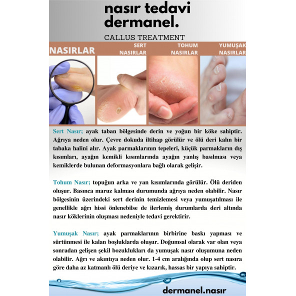 Dermanel Ayak Bakım Spreyi+Dermanel Nasır Tedavi Seti - 8