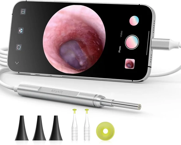 Anykit Dijital Otoskop, Ultra Net Görüşlü Kulak Kamerası - İpad/İphone/Android