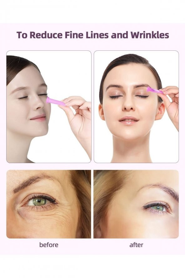 Silikon Masaj Kupası 5li Terapi Vakum Bardak Hacamat Anti Selülit Kas Gevşetici Seti - 3