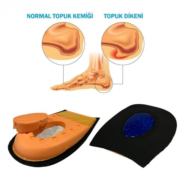 SRTfootcare Heelspur (Epin Topukluk) Hakiki Deri Jel Takviyeli Topuk Dikeni Yarım Tabanlık 1 Çift - 2
