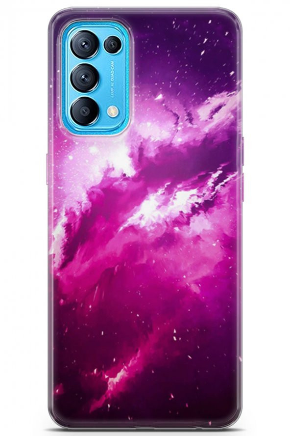 Oppo Reno 5 Pro Kılıf Orijinal Seri Moon 13 Patlama Case Kapak Fuşya