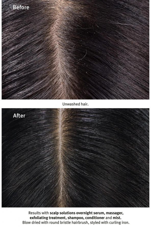 Aveda Scalp Solutions Saç Derisi Için Şampuan 1000ml - 5