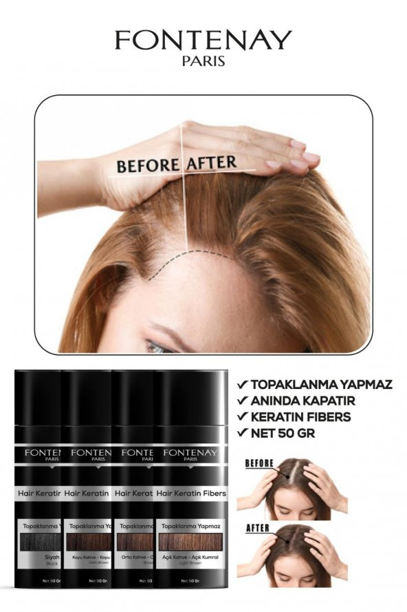 Fontenay Saç Dolgunlaştırıcı Keratin Fibers Koyu Kahve Topik Saç Tozu 50gr + Saç Spreyi 400ml 2li Set 2 - 3