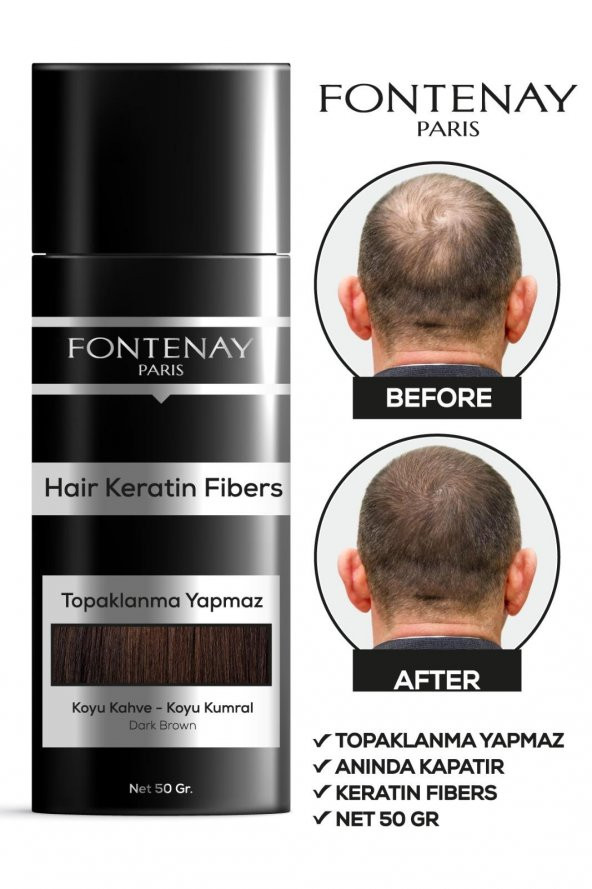 Fontenay Saç Dolgunlaştırıcı Keratin Fibers Koyu Kahve Topik Saç Tozu 50gr X3 - 2