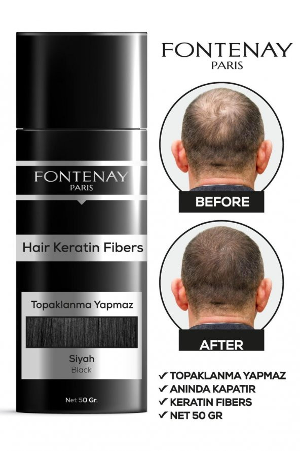Fontenay Saç Dolgunlaştırıcı Keratin Fibers Siyah Topik Saç Tozu 50gr X3 - 2